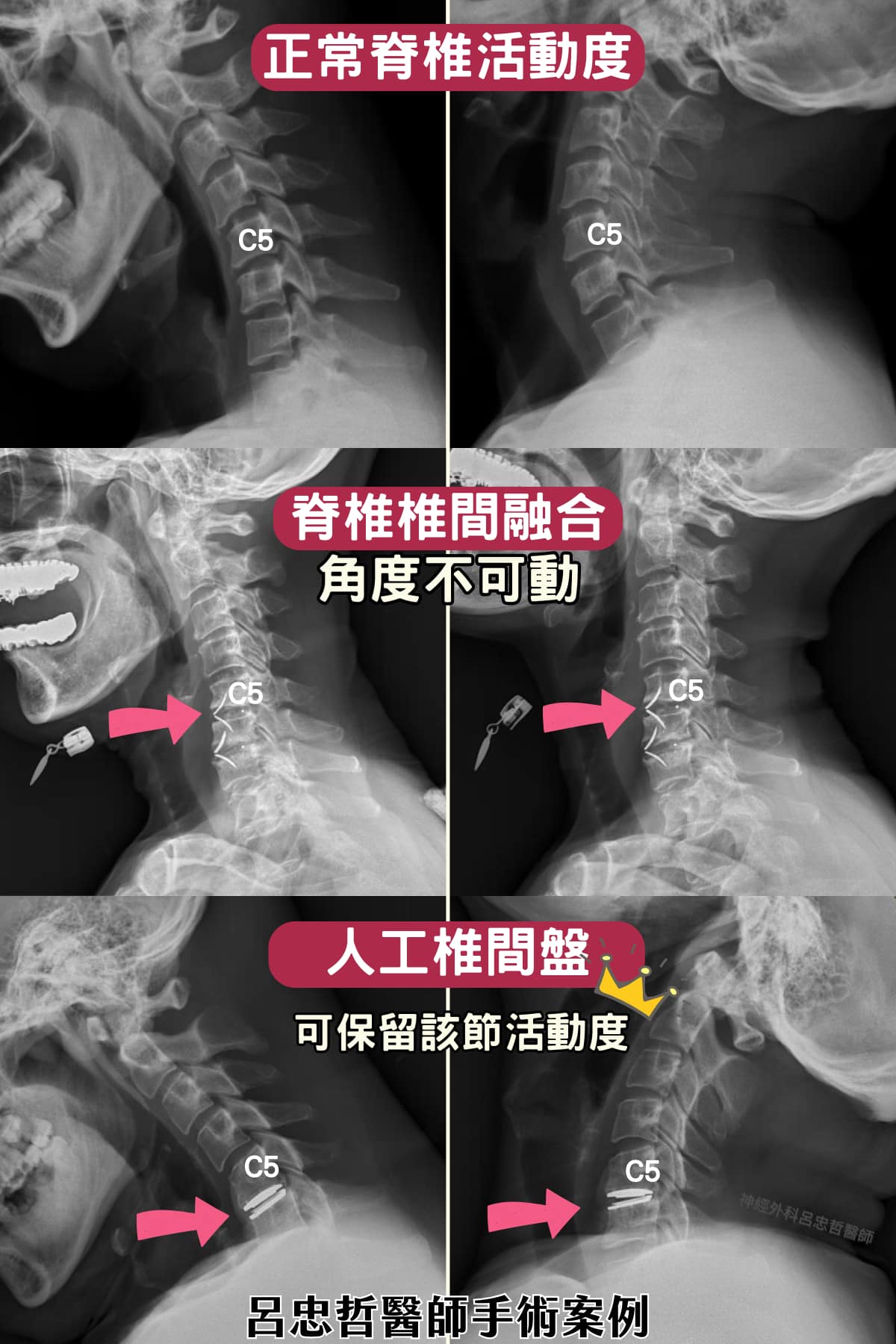 可能是 X 光、骨骼和文字的圖像